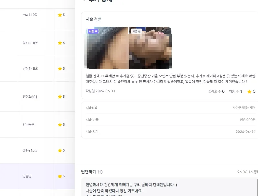 편평사마귀 고객 후기 7