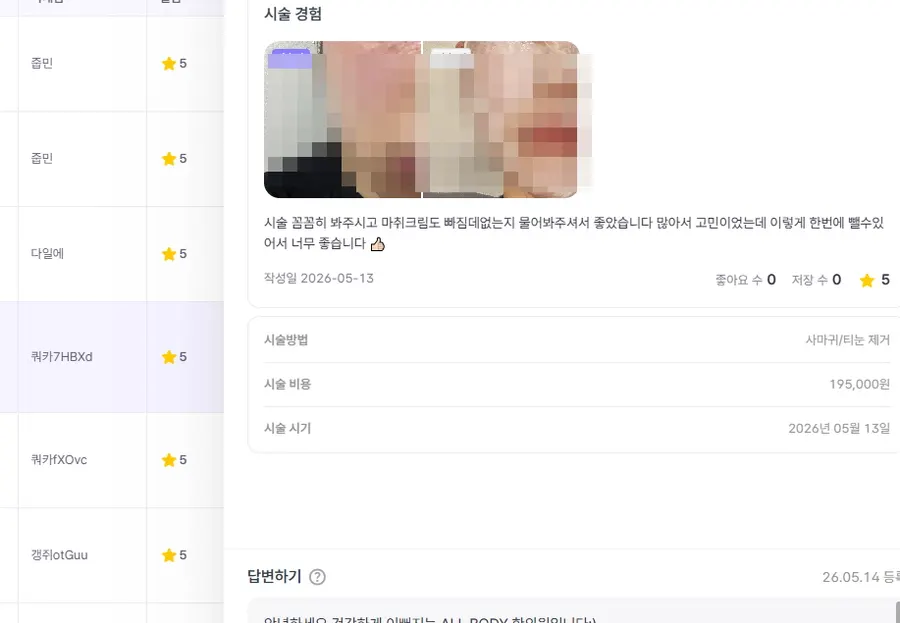 편평사마귀 고객 후기 10