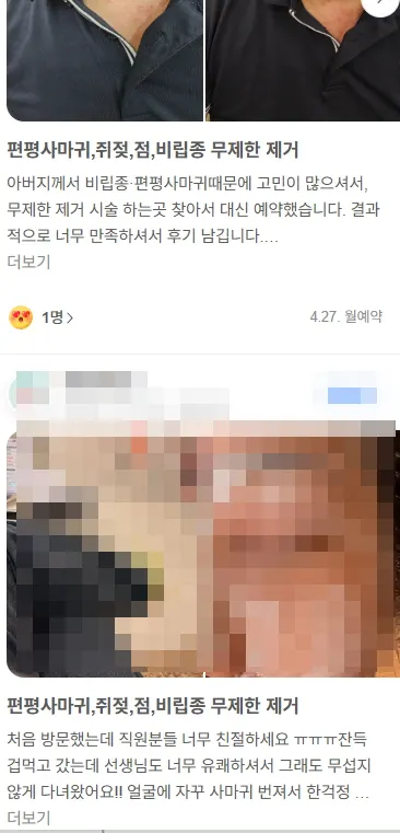 편평사마귀 고객 후기 8